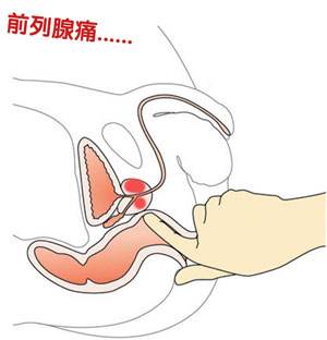 苏州治疗前列腺痛的医院