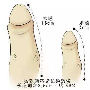 苏州生殖整形医院