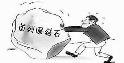 前列腺结石有什么危害