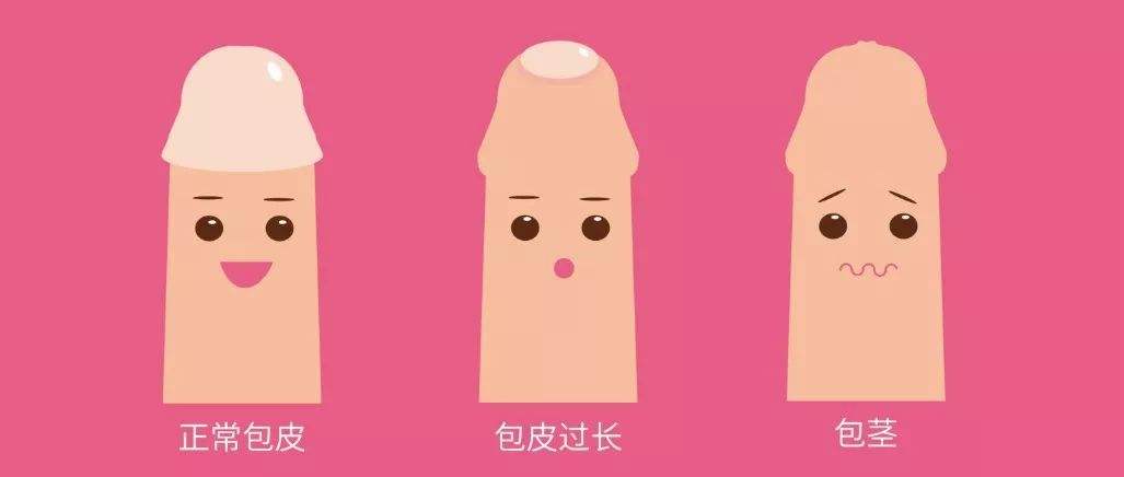 割包茎多久才能恢复