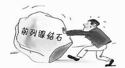 前列腺结石的危害_苏州男科医院那家好